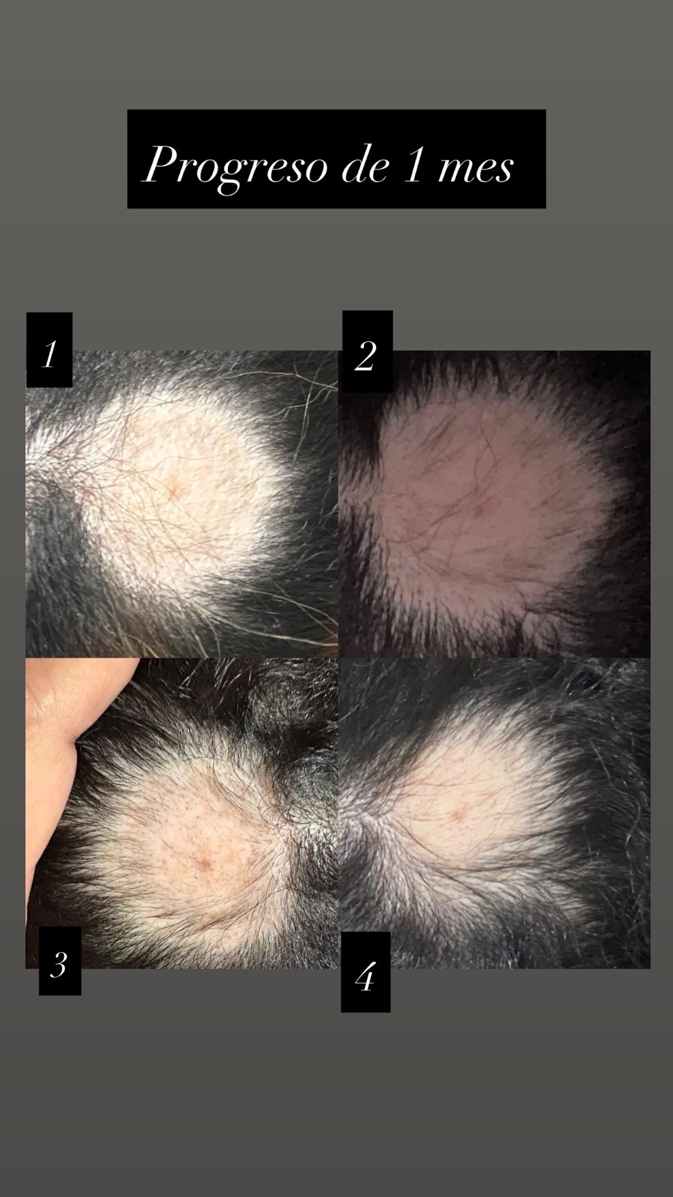 SHINEHAIR - Ritual Capilar Completo de crecimiento