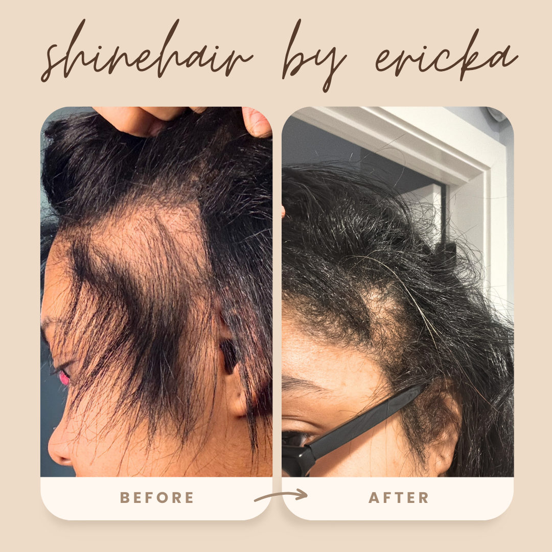 SHINEHAIR - Ritual Capilar Completo de crecimiento