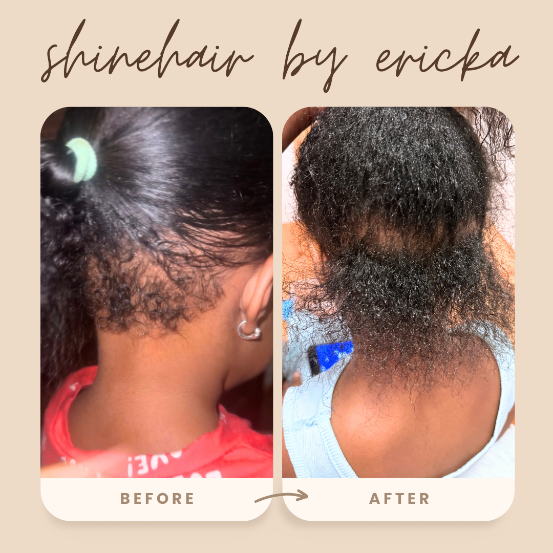 SHINEHAIR - Ritual Capilar Completo de crecimiento