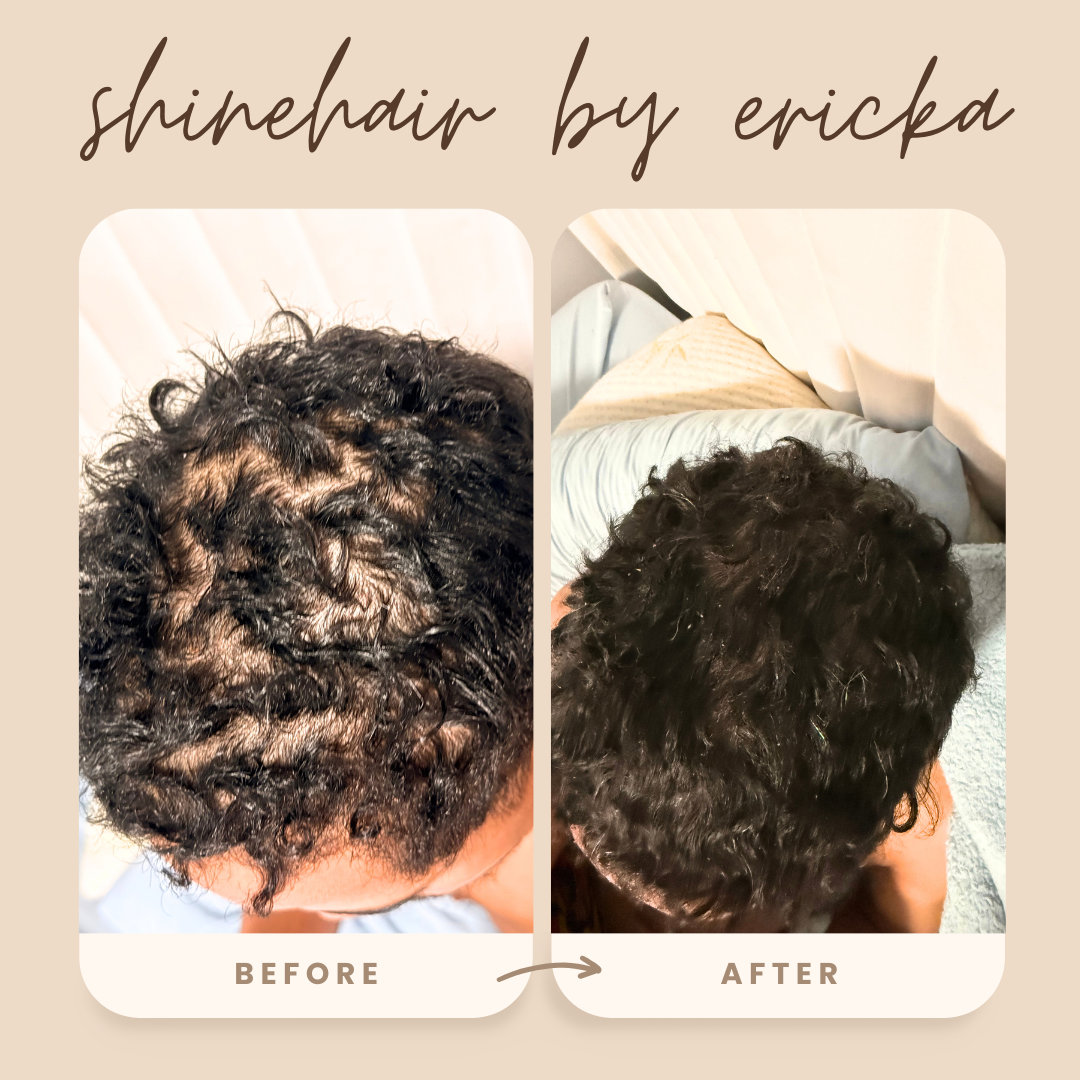 SHINEHAIR - Ritual Capilar Completo de crecimiento